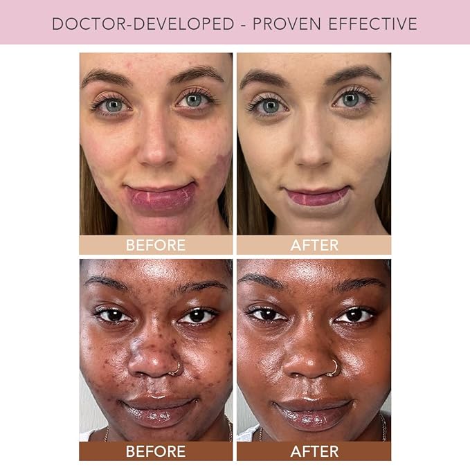 Doll 10 TCE Liquid Filter – CC Cream - Liquid Foundation - Lightweight Tinted Moisturizer & Skin Tint - Blurs Pores & Fine Lines - Vegan - Clean Makeup - [Medium] - 30 Day Supply