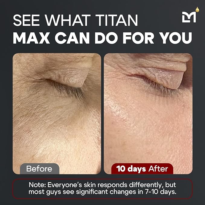 Titan MAX Anti-Aging Face Serum for Men – Ultra Potency Mens Face Moisturizer – Men, Dark Spots, Wrinkles, Fine Lines – Vitamin C & E, 10% Niacinamide, Hyaluronic Acid – Unscented