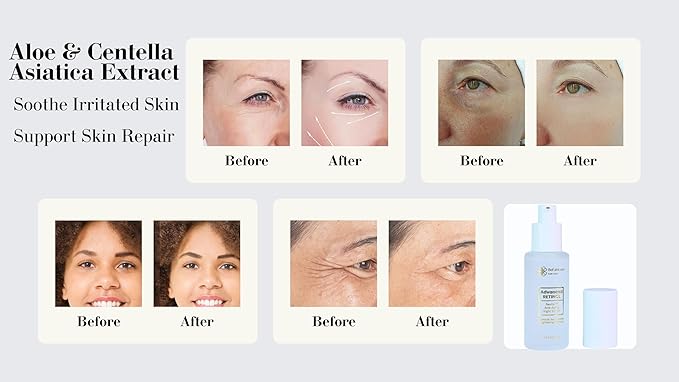 Advanced Retinol Serum Skin Booster- Face, Neck Anti Aging Night Serum - Hyaluronic, Niacinamide, Collagen, Glycolic Acid, Vitamin C & E for Wrinkles, Fine Lines & Dark Spots for Women & Men